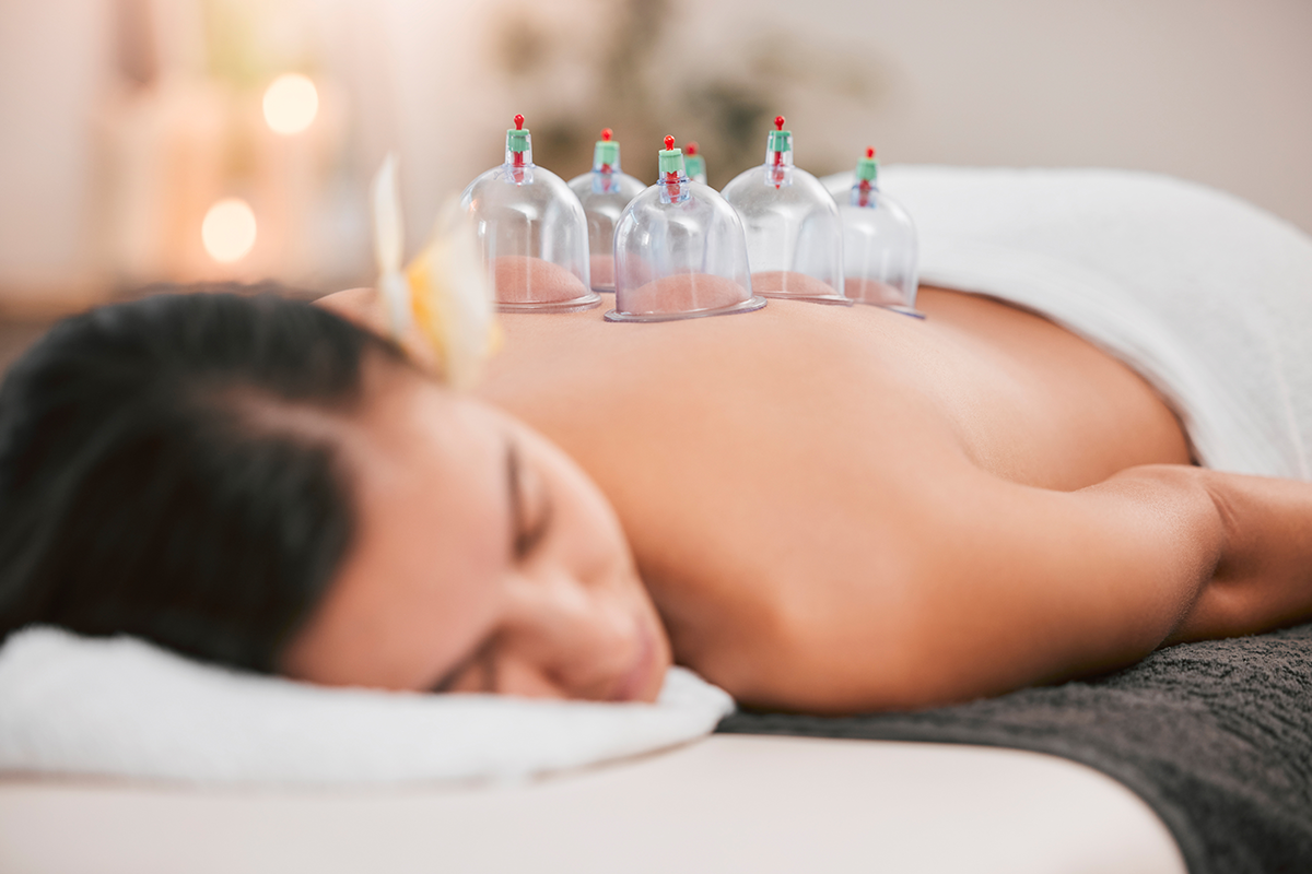 Cupping Therapy in Singapore: Benefits, Techniques & What to Expect