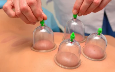 Curious About Cupping But Worried About the Marks?