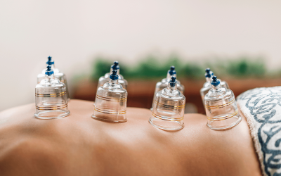 Massage Cupping in Singapore – A TCM Therapy for Healing & Relaxation