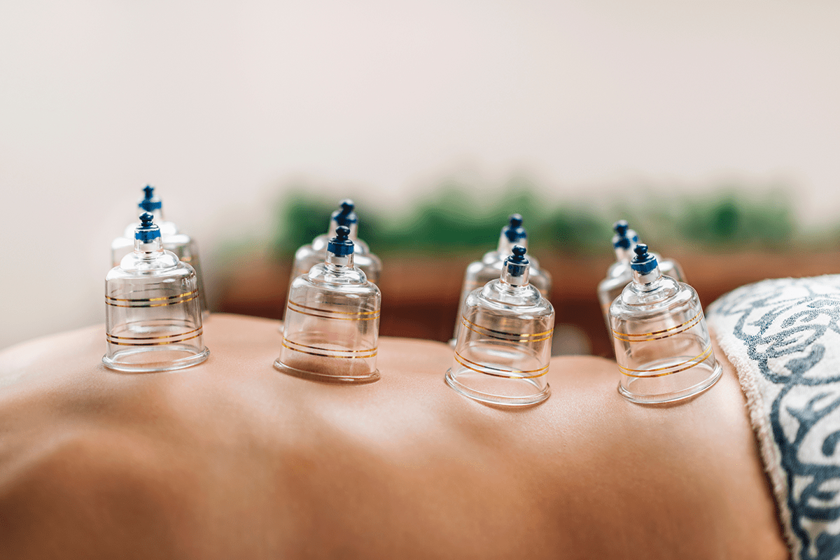 Air cupping session to relieve muscle tension and improve circulation